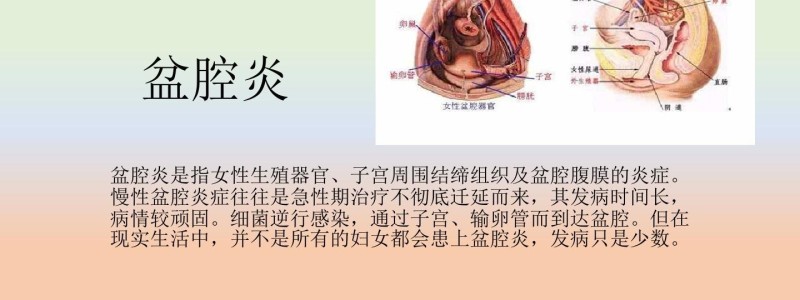 分类： <span>盆腔炎</span>